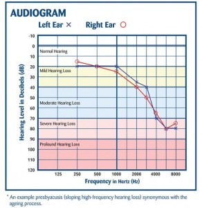 audiogram graph